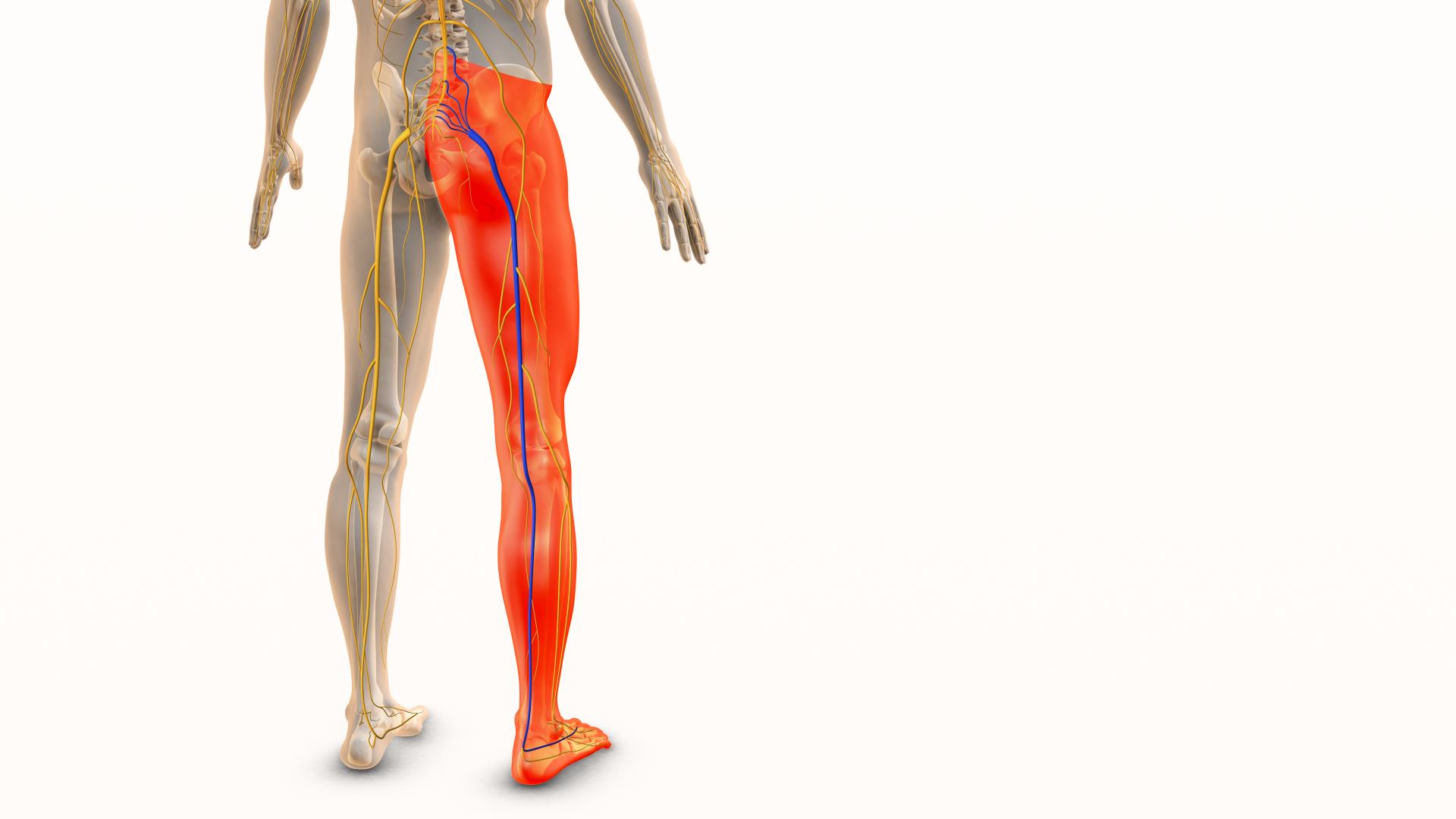 Are you managing your sciatica with medication? There is so much more you